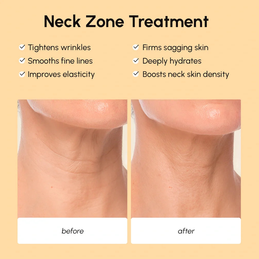 Lifting Neck Wrinkle Patches